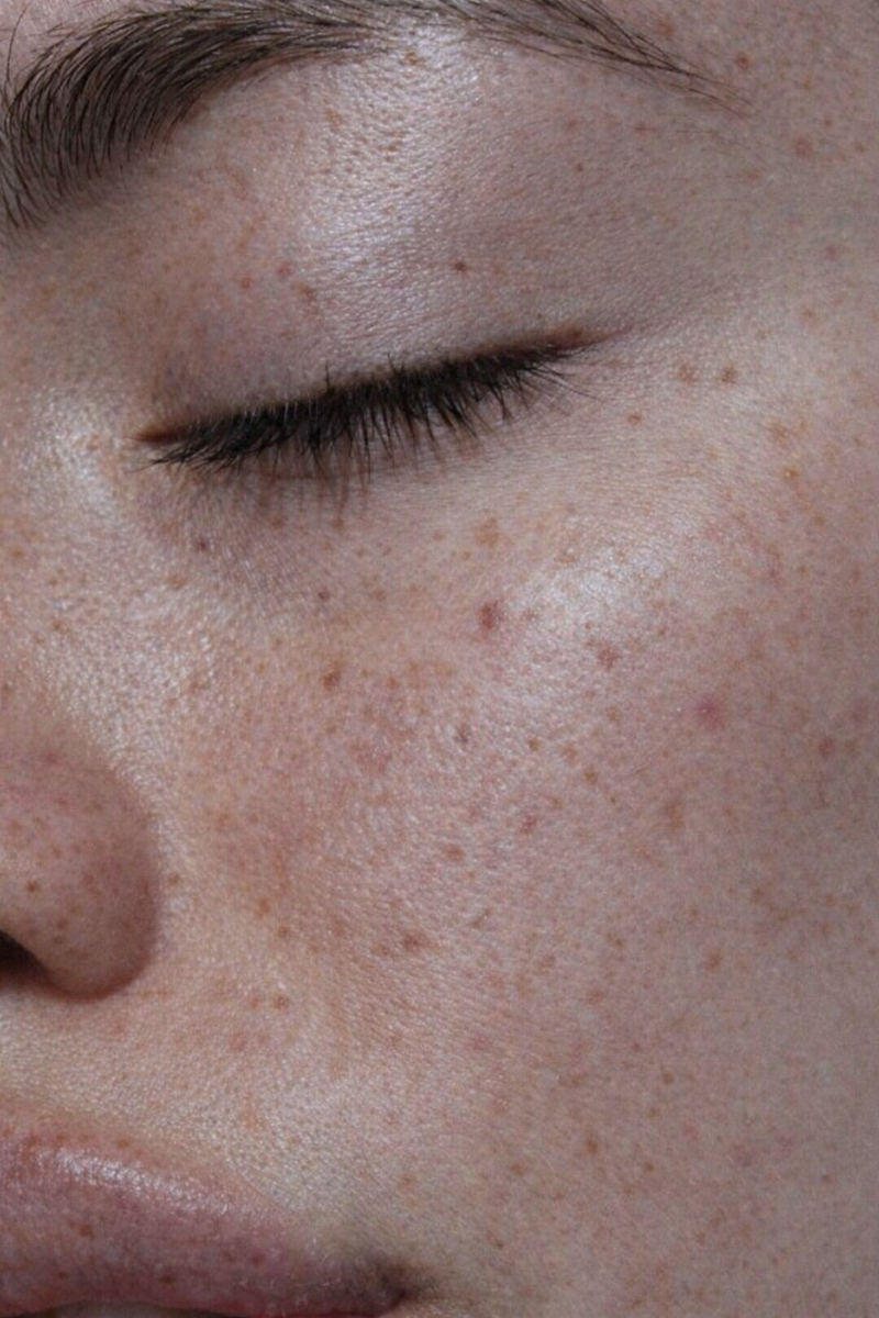 Smooth Texture - After
